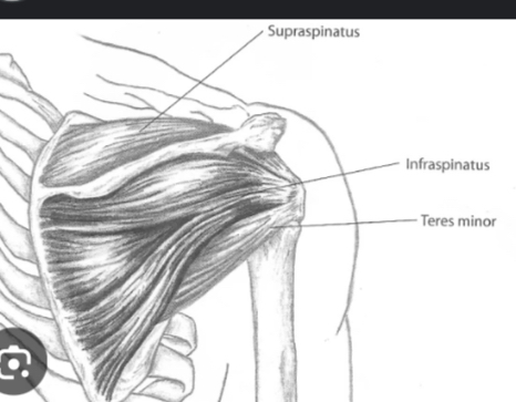 <p>Subscapularis.</p>