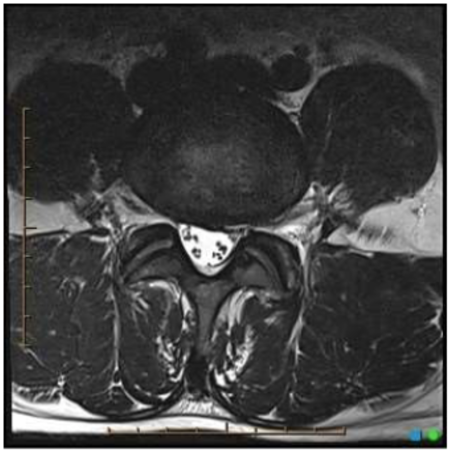 <p>What is the image weighting of this slice?</p>