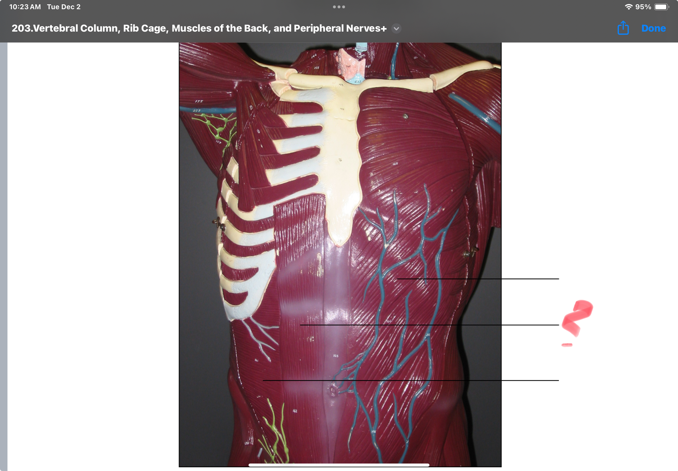 <p>Rectus abdominis Actions:Flexes vertebral column; compresses abdomen</p>