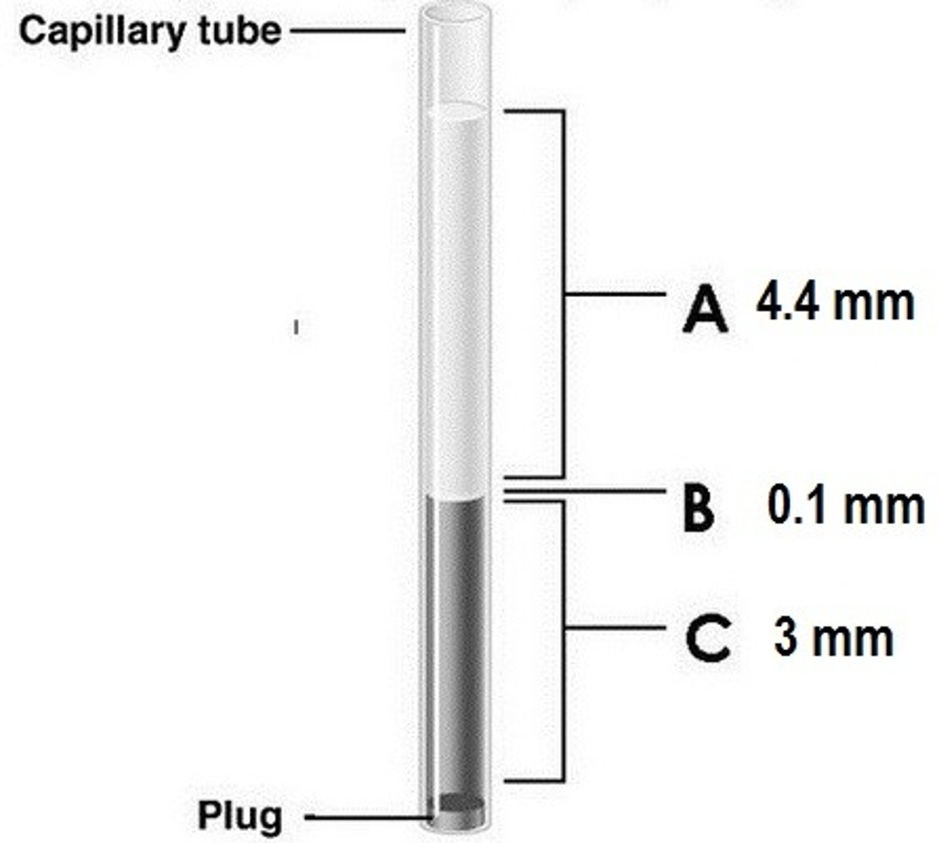 <p>Determine the hematocrit.</p>