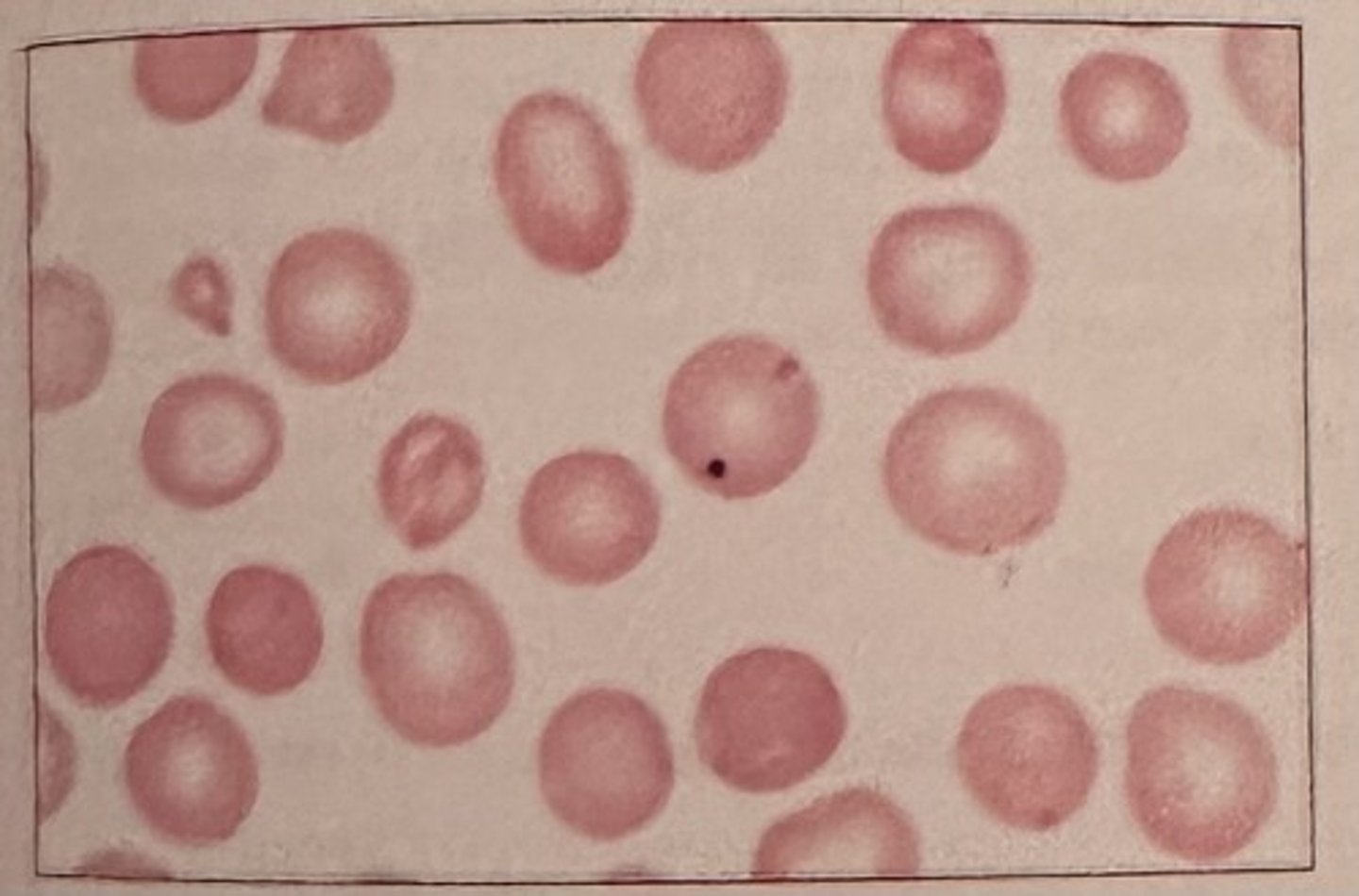 <p>a. DNA</p><p>Howell-Jolly bodies represent nuclear fragments remaining within the RBC cytoplasm after the nucleus has been extruded.</p>
