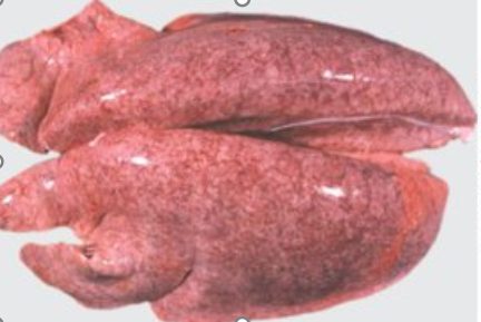 <p>Whats this? causes</p>