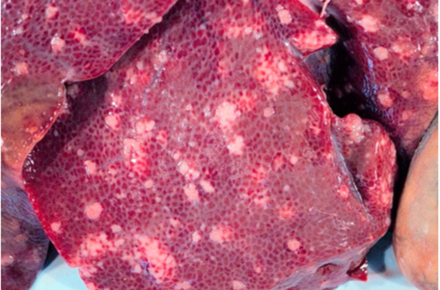 <p>Lever fra svin, hvad er den patoanatomiske diagnose og ætiologien?</p>