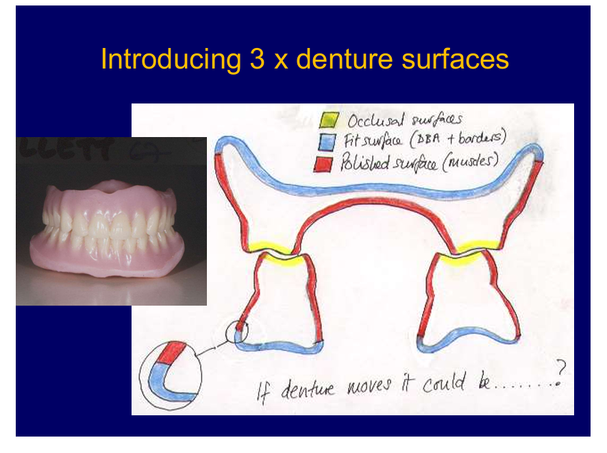 <p>polishes - oral mucosa and muscles underneath </p><p>why it moves - think of it in terms of which surface is responsible</p><p>e.g fit surface not very well fitting - fit surface</p><p>polished surface - not right shape the muscles can exrt forces on denture causing it to move</p><p>occlusal surfaces - if they meet nicely and occlusal plane is even - denture should remain in place</p>
