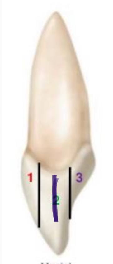 <p>what division is this in the facio-lingually (crown)</p>