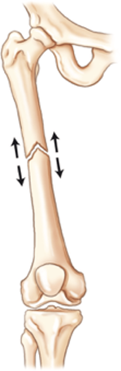 <p>the ends of fragments are aligned but pulled apart and are not making contact with each other</p>