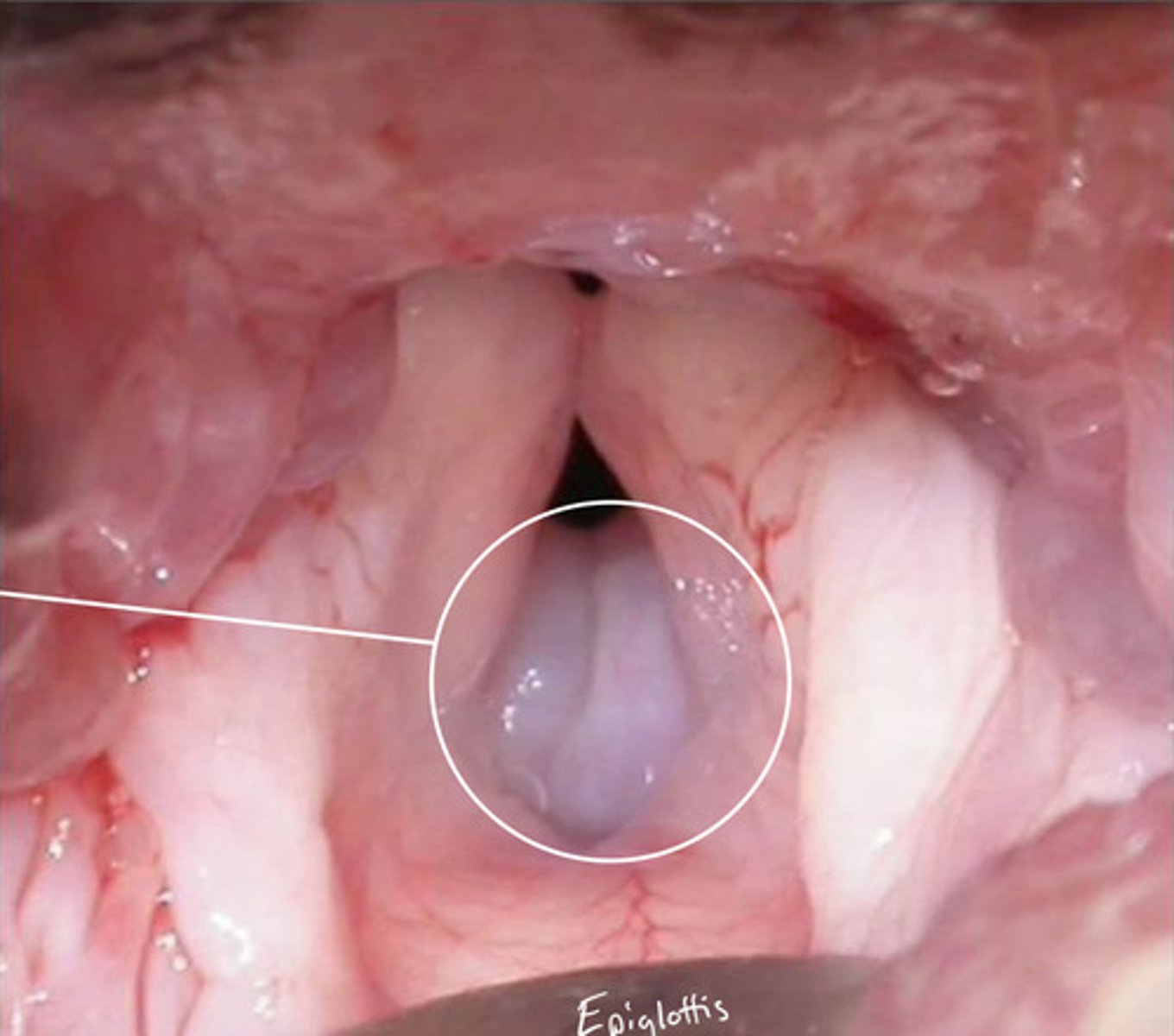 <p>Identify the pathology?</p>