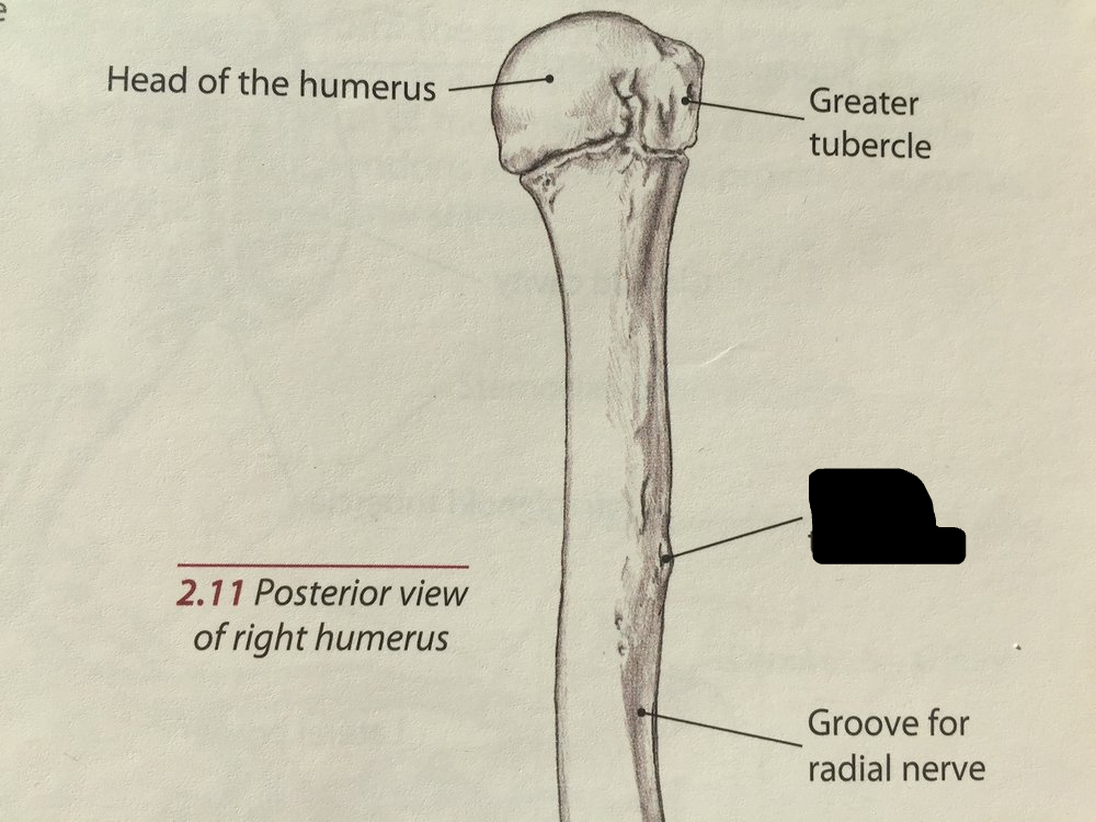 <p>deltoid tuberosity</p>