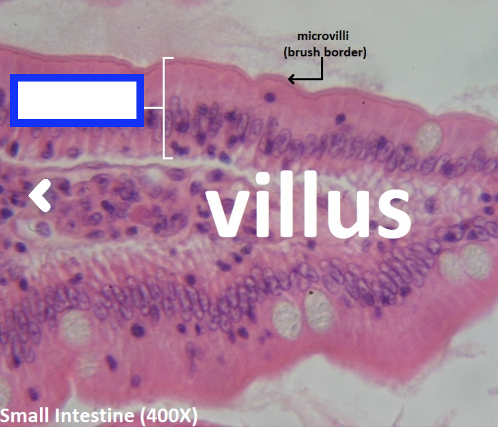 <p>simple columnar epithelium</p>