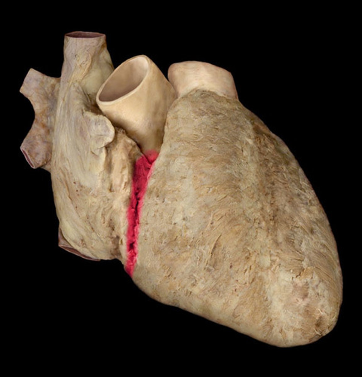<p>Depression, goes from Right auricle to Left auricle, probe lays in</p><p>H1</p>