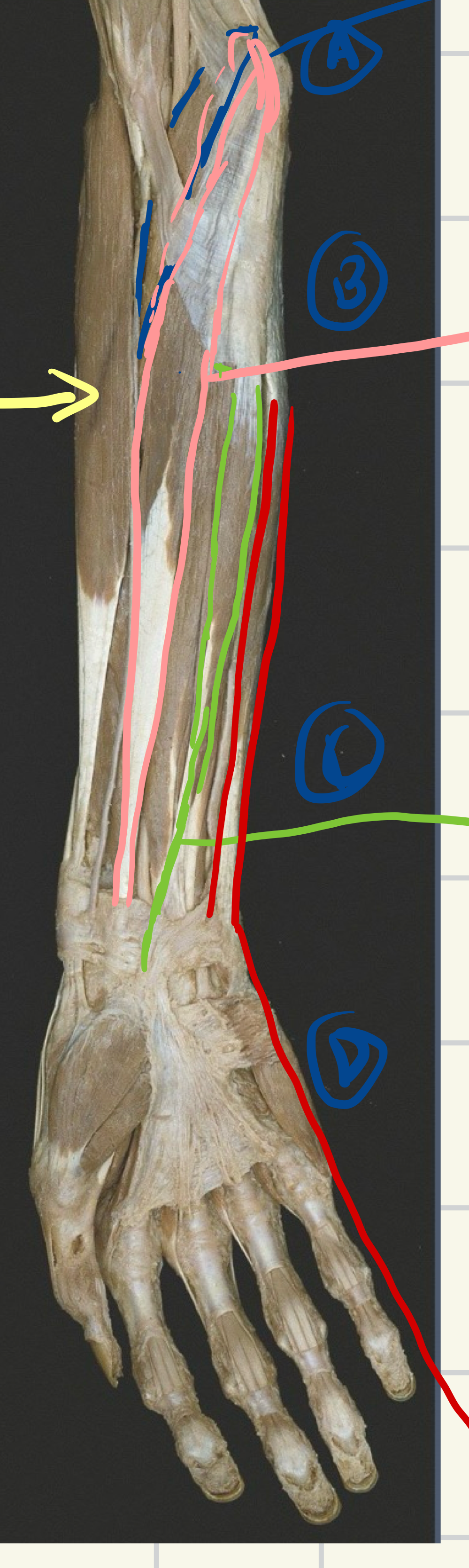 <p>What muscle is the yellow arrow pointing at ? (Origin, insertion, action, innervation)</p>