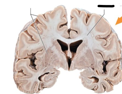 <p>Myelinated axons </p><p>deep to brain structures</p><p>F: communication to and from grey areas and between gray areas and rest of body</p><p>developments peaks middle age</p>