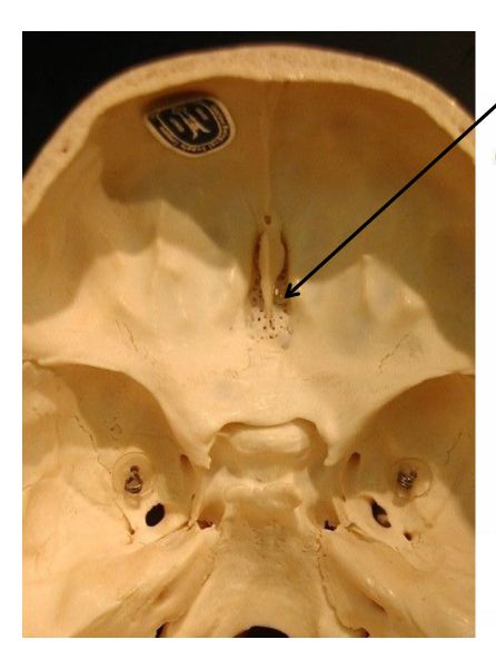 <p>what is the arrow pointing at?</p>