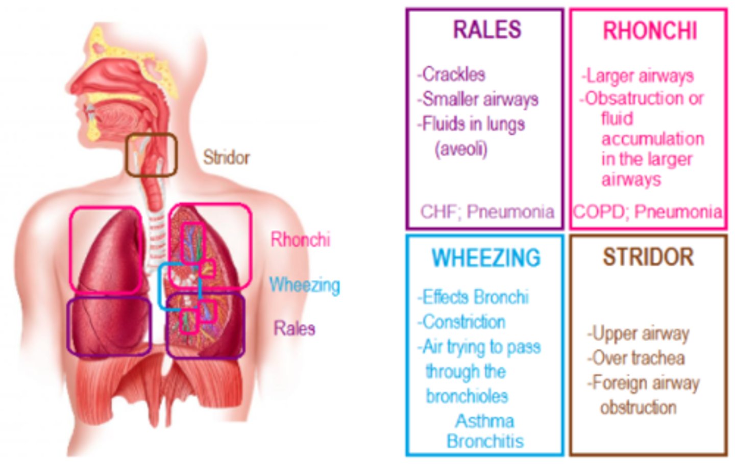 <p>crackles (rales): popping, bubbling; fluid in alveoli (CHF, pneumonia)</p><p>wheezes: high-pitched musical; narrowed airways (asthma, COPD)</p><p>rhonchi: low-pitched snoring; thick secretions in larger airways</p><p>stridor: harsh, upper airway obstruction: EMERGENCY</p>