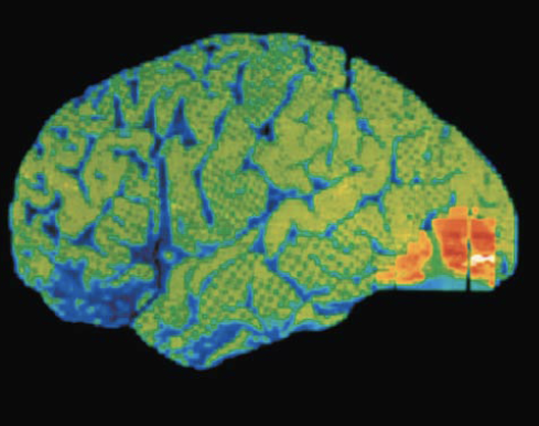 term image