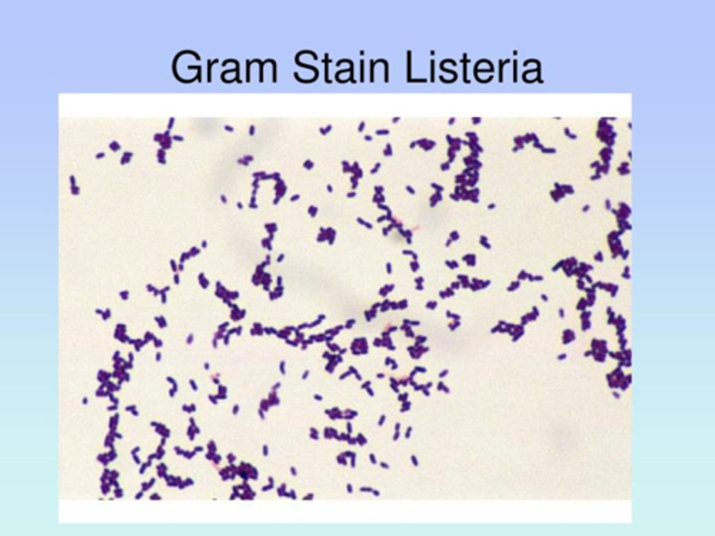 <p>Listeria Monocytogenes</p>