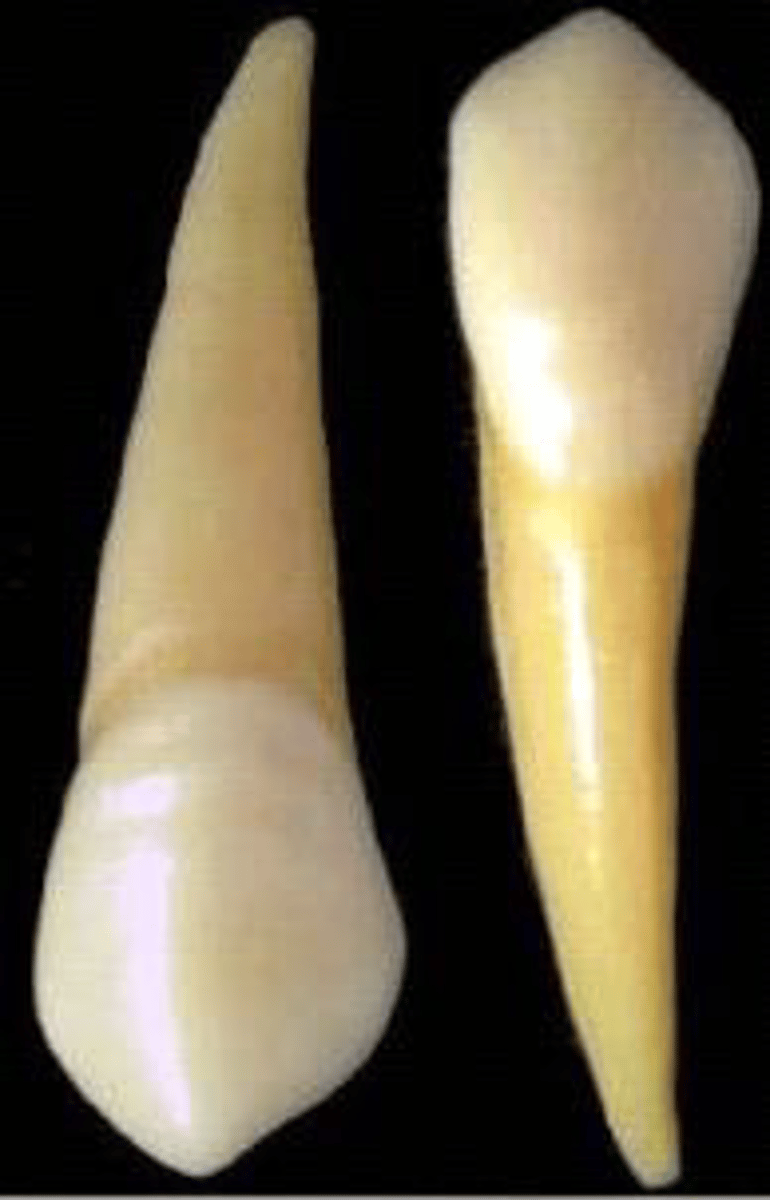 <p>what teeth are these?</p>