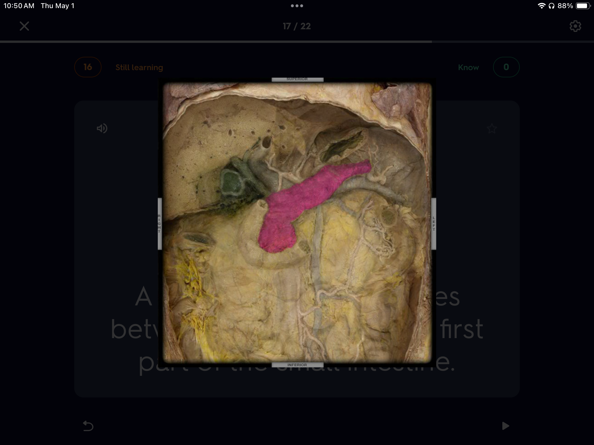 <p>What is the name of this organ highlighted? </p>