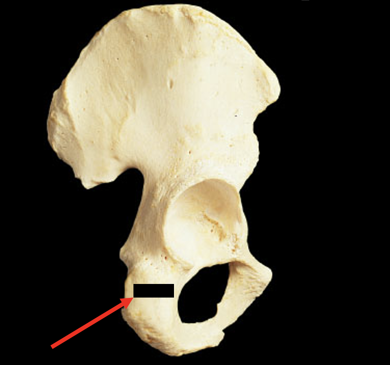 Name this region of the pelvis