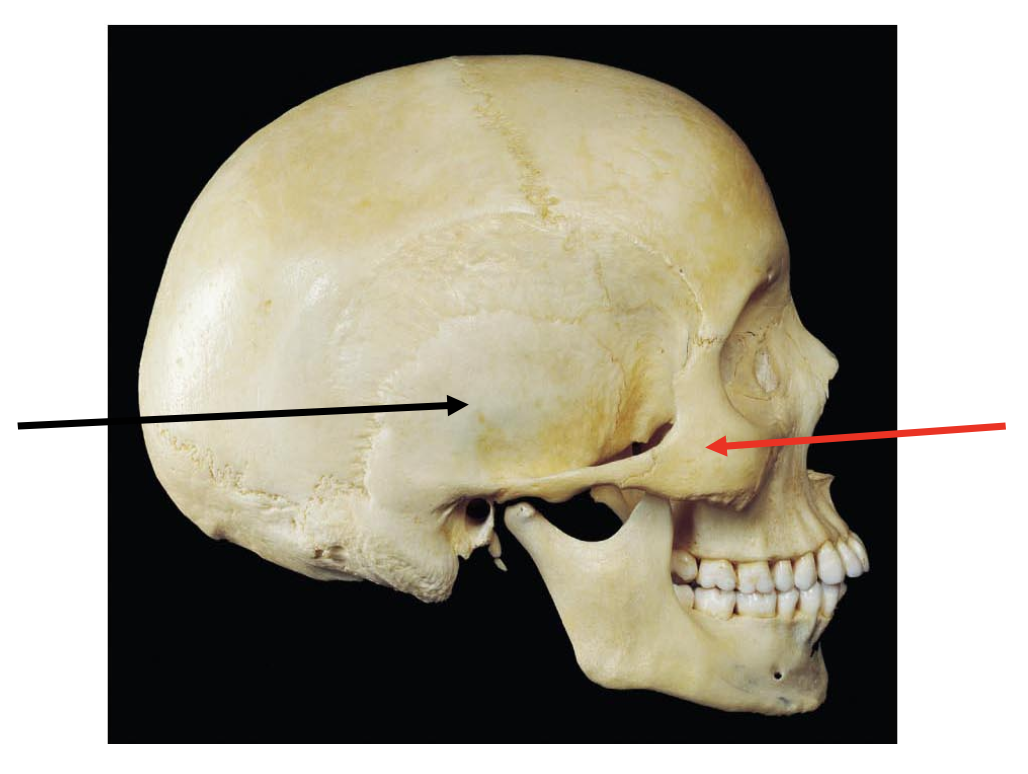 <p>The black arrow is pointing to the </p><p></p><p>A. parietal bone</p><p>B. occipital bone</p><p>C. temporal bone</p><p>D. frontal bone</p>