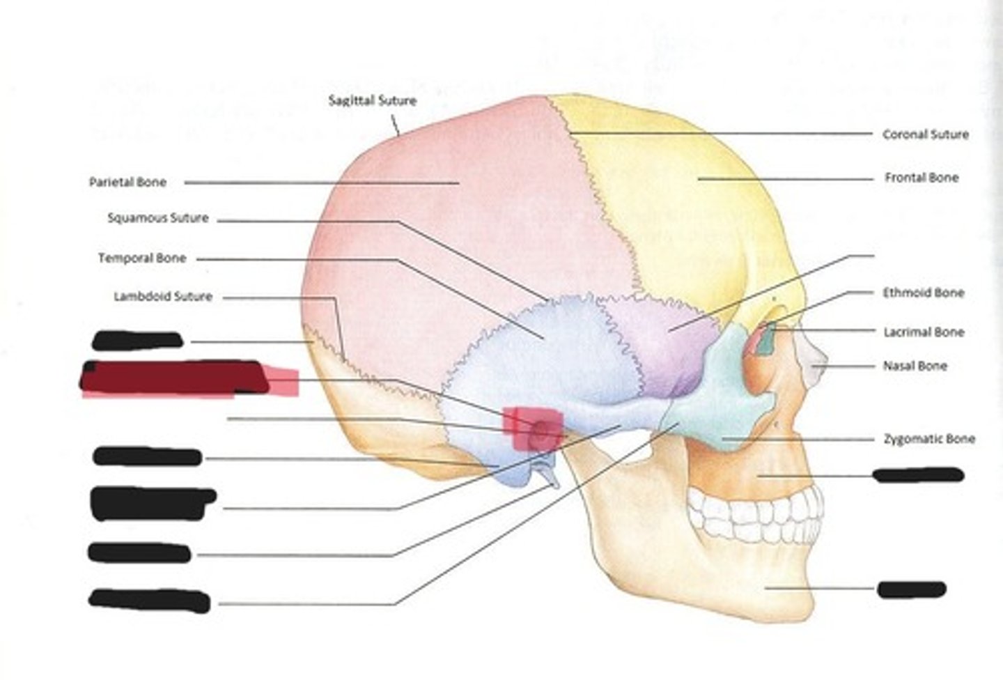 <p>External acoustic meatus of the temporal bone</p>