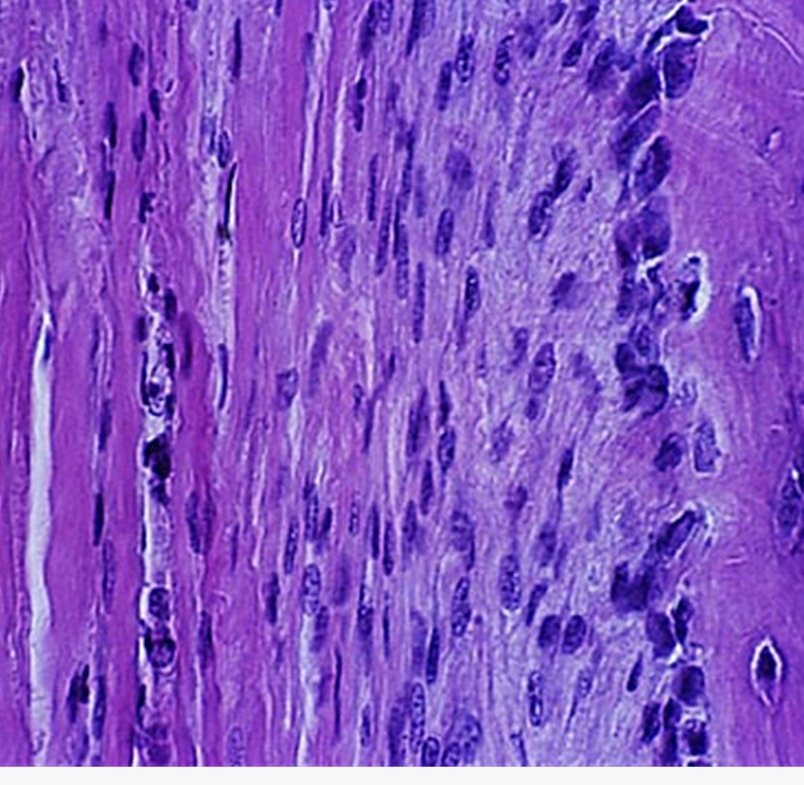 <p>Células derivadas del mesénquima, se dividen por mitosis y se diferencian en osteoblastos. Se ubican en la capa interna del periostio, endostio y conductos intraóseos</p><p>Forma de huso con núcleo oval</p>
