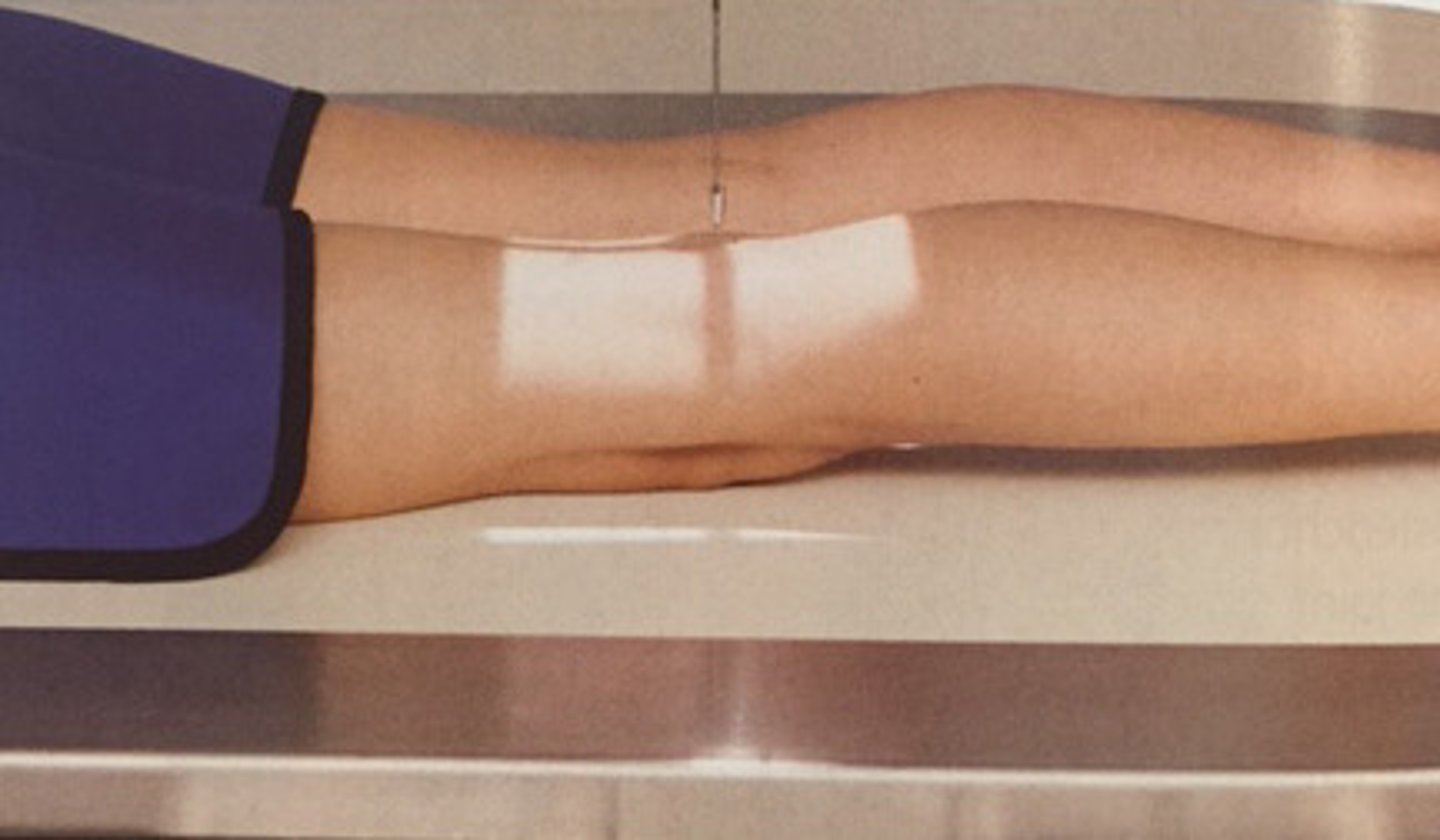 <p>pt in prone position, legs extended</p><p>true PA: align interepicondylar line parallel to plane of IR (requires about 5 degrees internal rotation of anterior knee)</p>