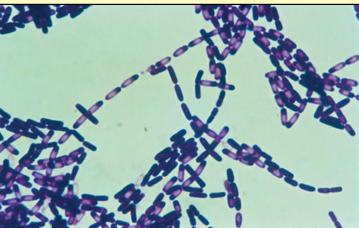 <p>What is shown in the image?</p><p></p><p>a) <em>Clostridium </em></p><p>b) <em>Bacillus </em></p>