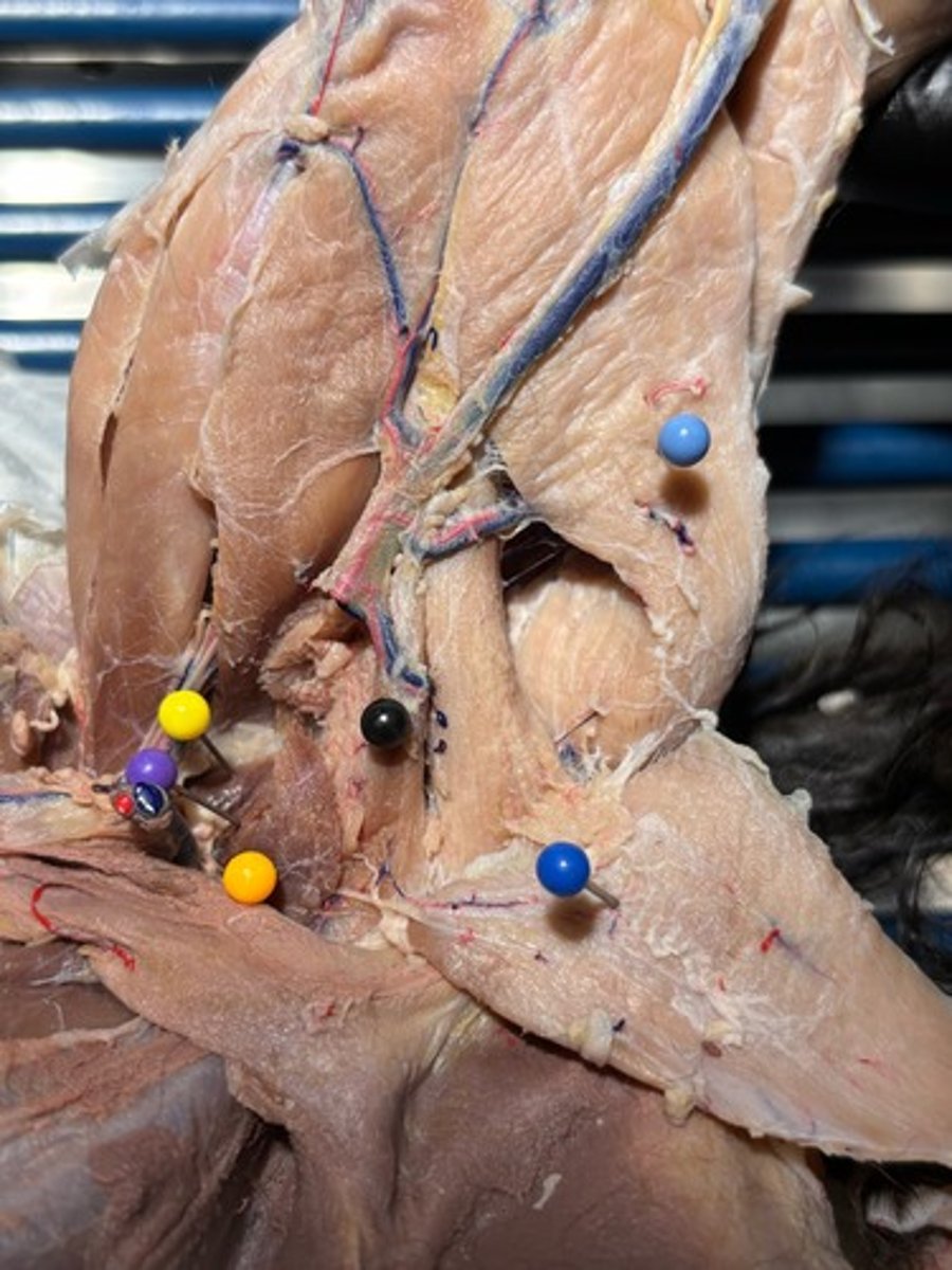 <p>What thigh muscle is the black pin in</p>