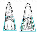 <p>The longest uneven side of the incisor is towards the _____</p>