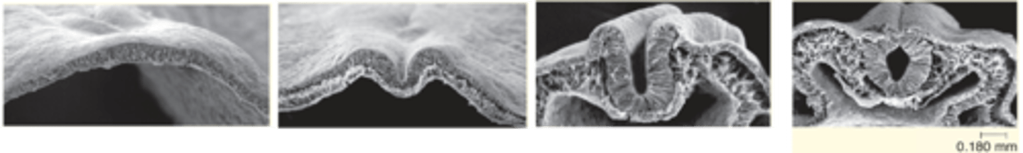 <p>The tube formed in neurulation becomes the ___________ _______</p>