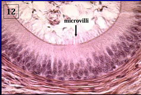 <p>Ductus epididymidis. </p><p>The duct of the epididymis is <strong>lined by a pseudostratified columnar epithelium with long microvilli called stereocilia</strong> (they are not the same as motile cilia). '</p><p>Note the presence of spermatozoa in the lumen.</p>