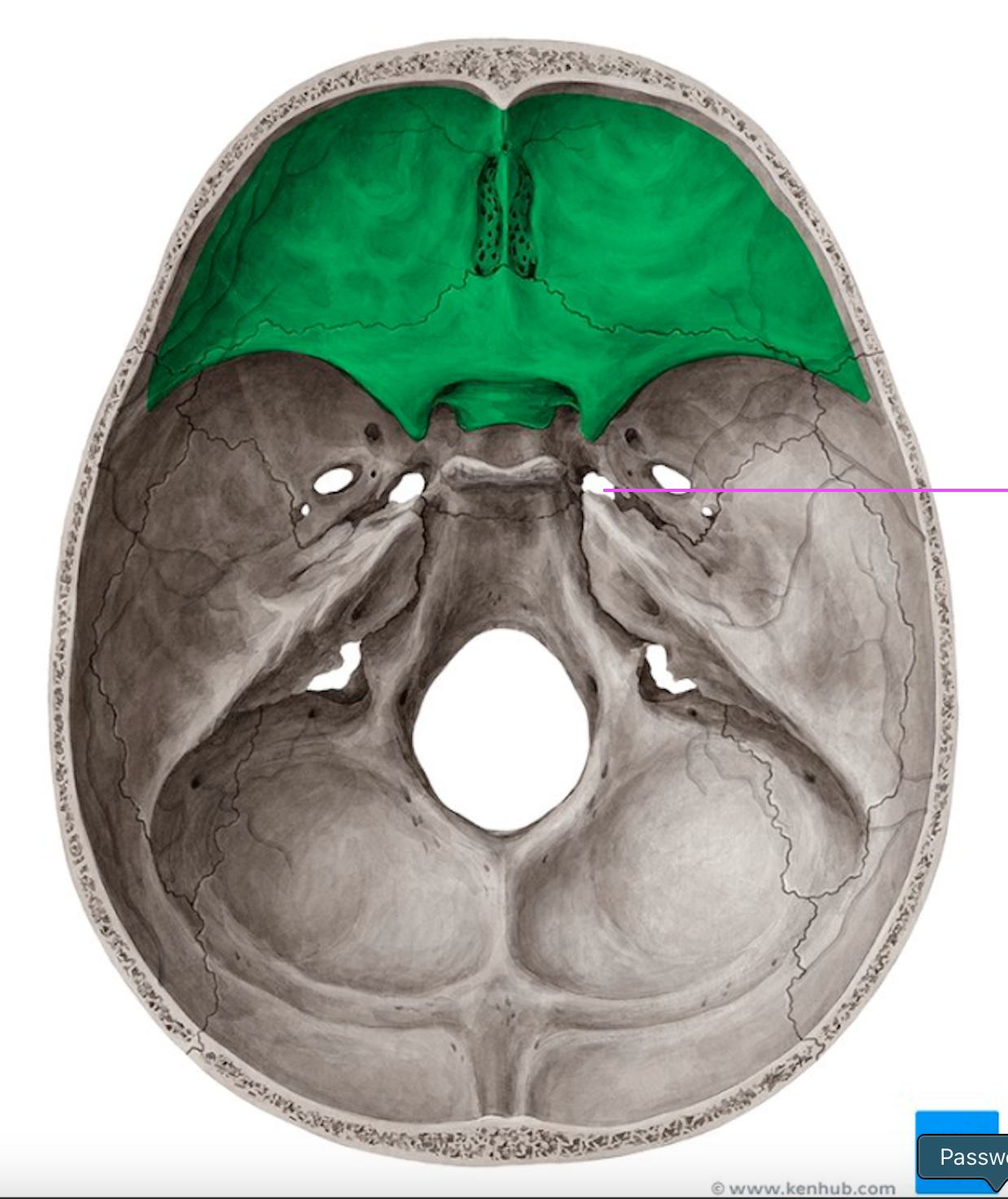 <p>What bone marking is this?</p>