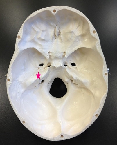<p>Identify the bone.</p>