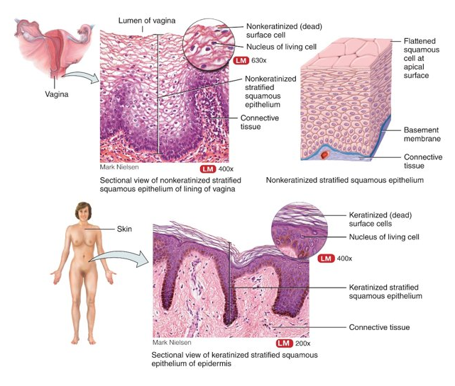 <p>top layer of cells is flat, deeper layer of cells vary in shape from cuboidal to columnar; non-keratinized: mouth and esophagus, keratinized (very water-resistant protein): superficial layer of skin</p>