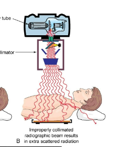 <p>Is this image good collimation or bad</p>