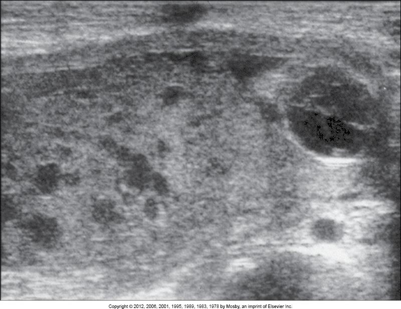 <p>what is this image showing?</p>