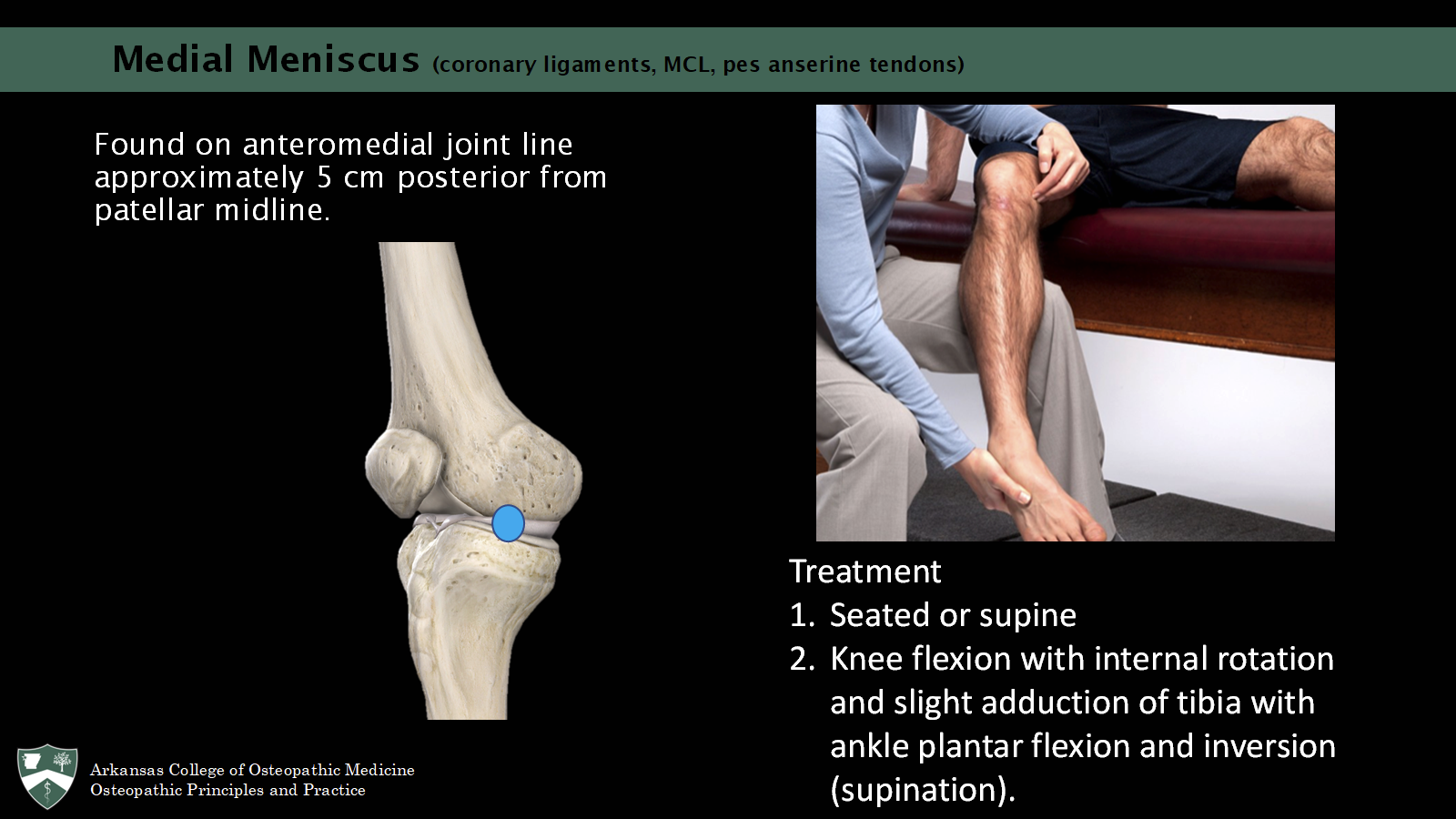 <p><span>Found on anteromedial joint line approximately 5 cm posterior from patellar midline.</span></p><p><span>Seated or supine</span></p><p><span>Knee flexion with internal rotation and slight adduction of tibia with ankle plantar flexion and inversion (supination). </span></p>