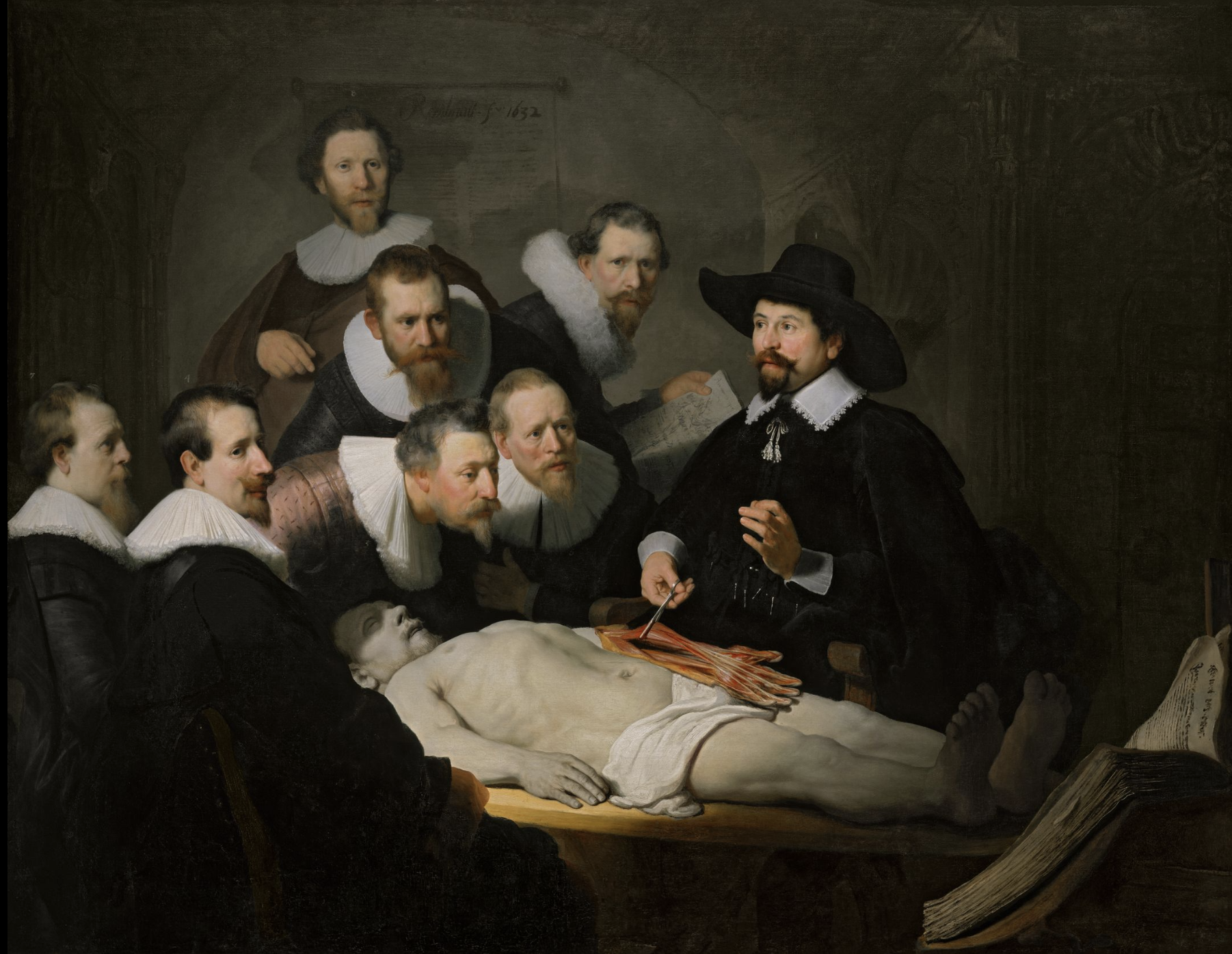 <p>Members of the anatomy guild in Amsterdam exclusively dissected criminals because it was the exception to the churches views on dissection since they thought people would be resurrected. Once a year, the guild would hold a public lecture where they would dissect the body of a criminal who was hung earlier that day. Main dr. would lecture while assistants performed the actual dissection. Every 5-10 years, guild would commission a portrait to hang in the guild hall. Everyone in the painting contributed, if one wanted a more prominent place in the portrait, they would pay more. The corpse was a 28 year old man, hung for assault and battery, body is foreshortened. Figures here would have wanted to be recorded as among Amsterdam’s scientific elite.&nbsp;</p>