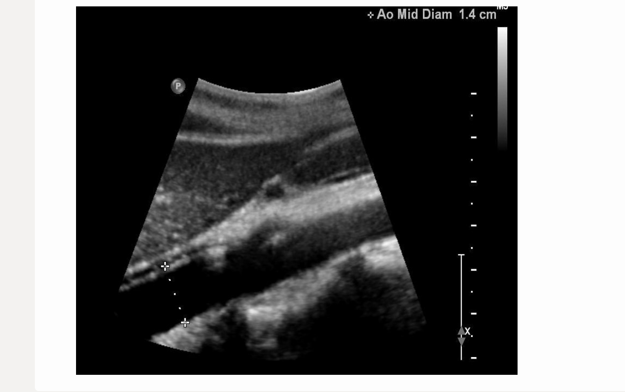 <p>this image is </p><p>.</p><p>a) incorrect label + diameter </p><p>b) correct label; incorrect diameter</p><p>c) correct label; correct diameter</p><p>d) incorrect label; correct diameter</p>