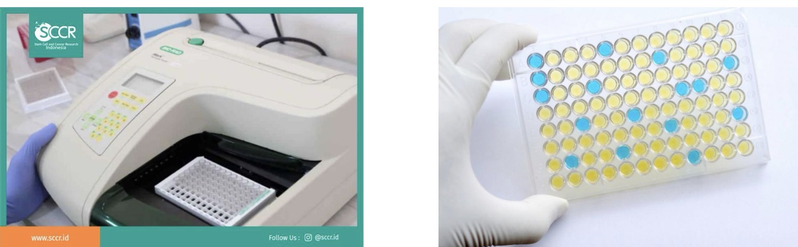 <p>A- what is the method of examination used here</p><p>B- Identified the method in the picture</p><p>C- what is importance</p><p>D- what organism can found in this method</p><p>E- give other examples of same method</p>