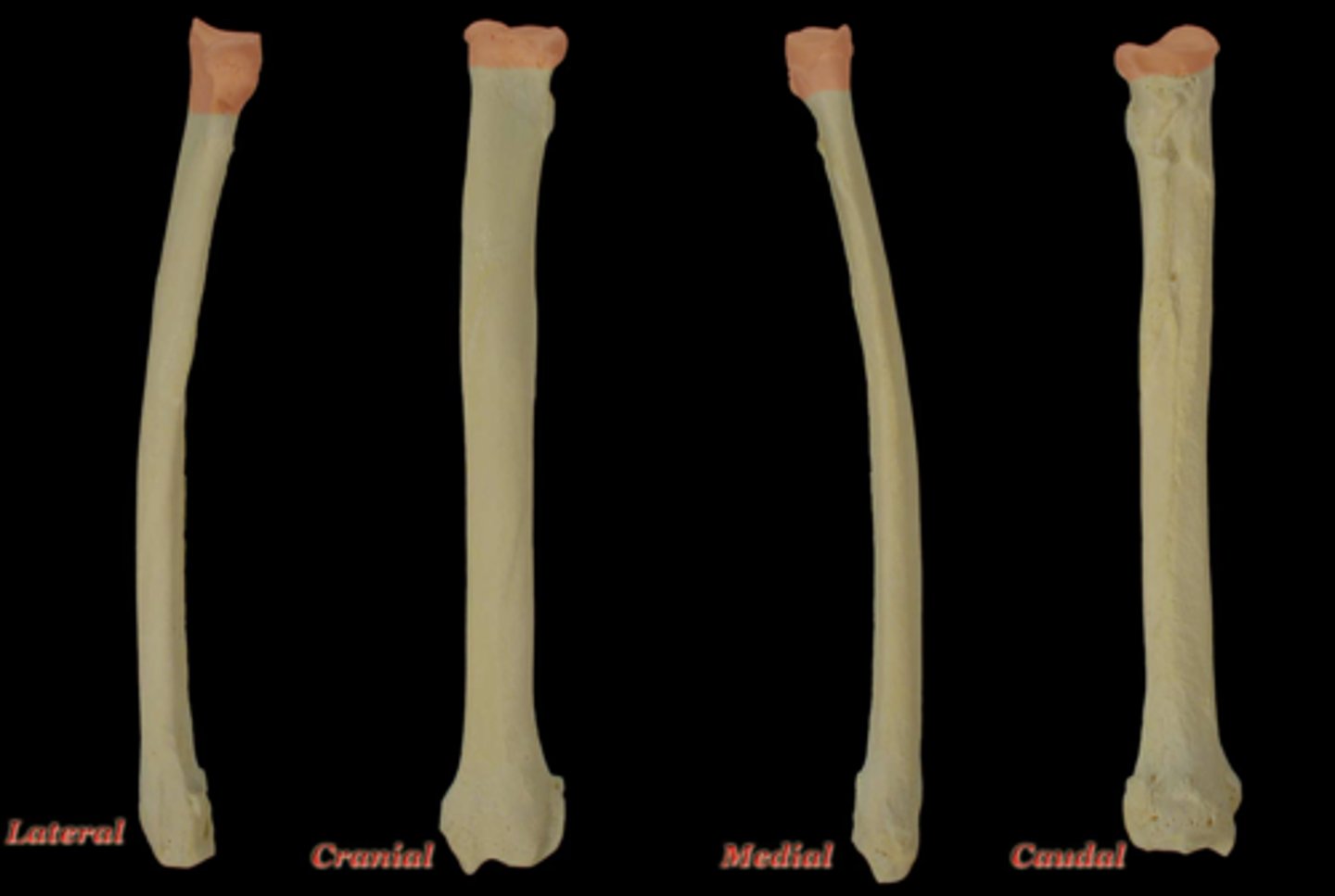 <p>What structure is highlighted in this picture?</p>