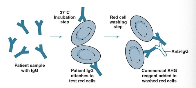 <ul><li><p>Detects IgG or complement bound to RBCs in vitro </p></li><li><p> Two-step procedure</p><ol><li><p>Antibodies (in serum) are incubated at 37° C with RBC antigens in vitro</p></li><li><p>RBC suspension is washed and then combined with AHG reagent to detect agglutination</p></li></ol></li></ul><p></p>