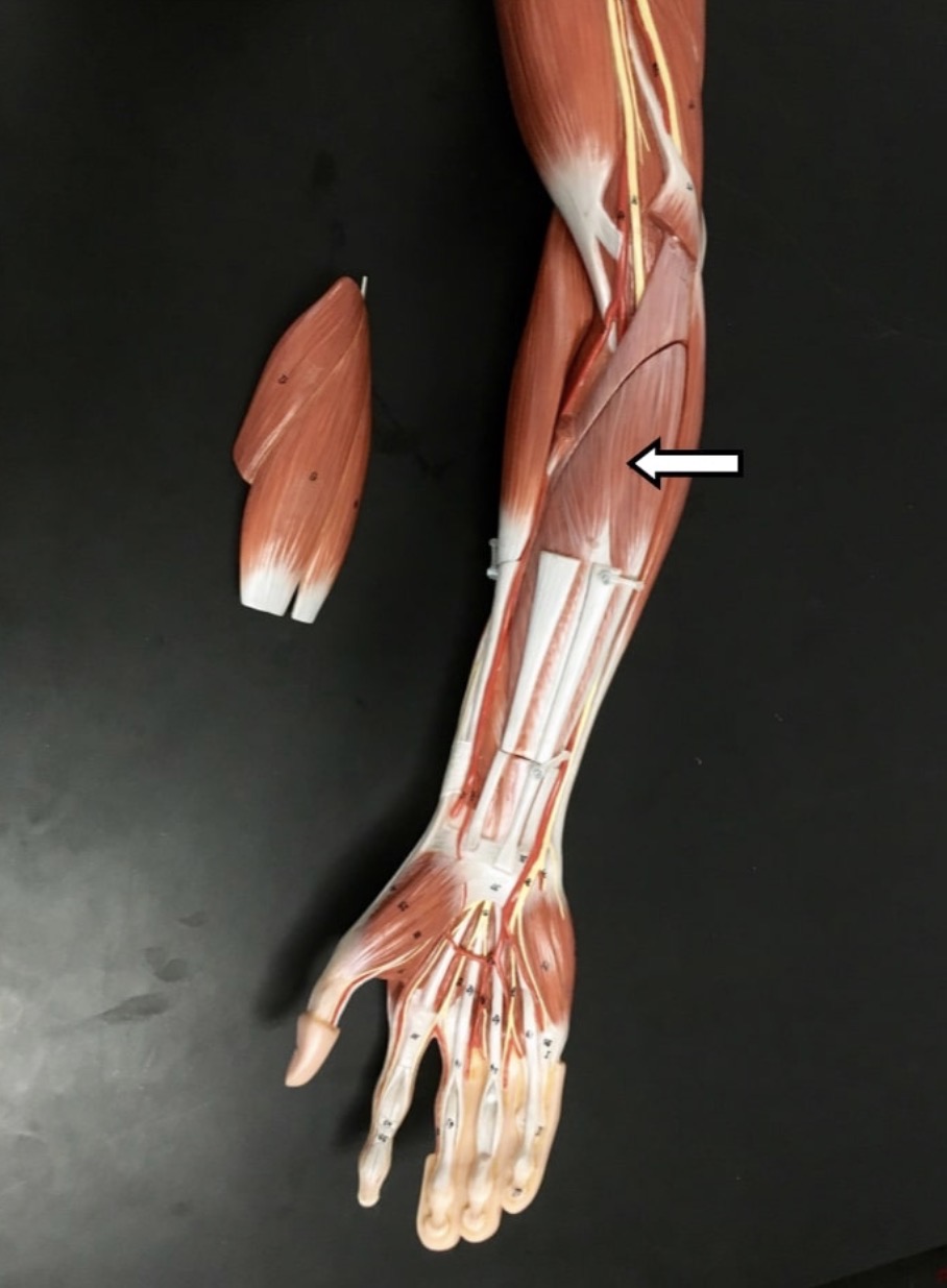 <p><span>Name the muscle labeled with the white arrow and name one action.</span></p>