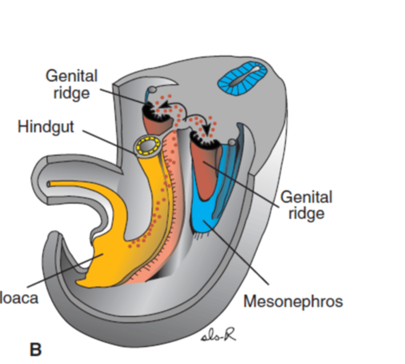 <p>1. Establishment of sex chromosomes at fertilisation (XX or XY), including the sex determining region on Y (SRY).</p><p>2. Depending on the presence of SRY or not then determines how the modelling of embryonic gonadal tissue occurs (ovaries or testes form).</p><p>3. This gonadal tissue permits controlled, programmed regression and growth of different parts of the indifferent tubular and external genital tissues. This is referred to as the establishment of genital phenotype (genitals develop as female or male phenotype). </p><p>E.g.- AMH produced the Sertoli cells of the male gonads causes regression of the paramesonephric ducts, preventing female reproductive structures from forming (fallopian tubes, uterus, vagina). Also the presence of testosterone, produced by the Leydig cells in the male gonads makes the mesonephric ducts develop into the epididymis, vas deferens, seminal vesicles and ejaculatory ducts. Without testosterone the mesonephric duct regresses.</p>