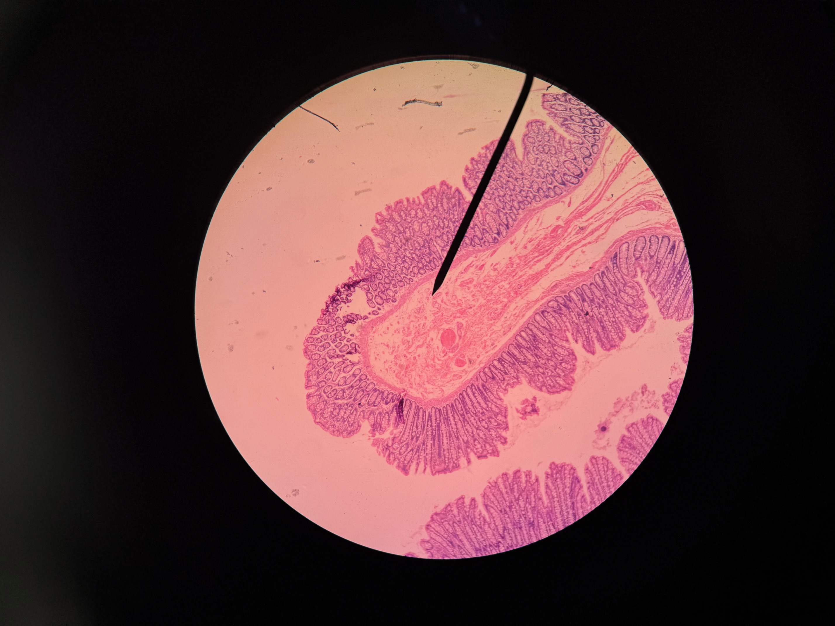 <p>Organ?</p>