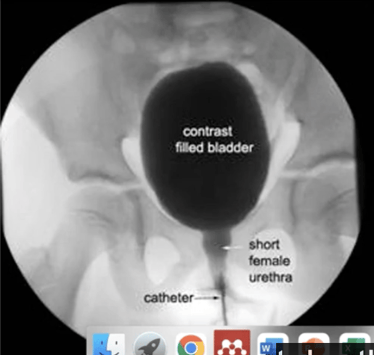 <p>A narrow, musculomembranous tube with a sphincter muscle at the neck of the bladder.</p>