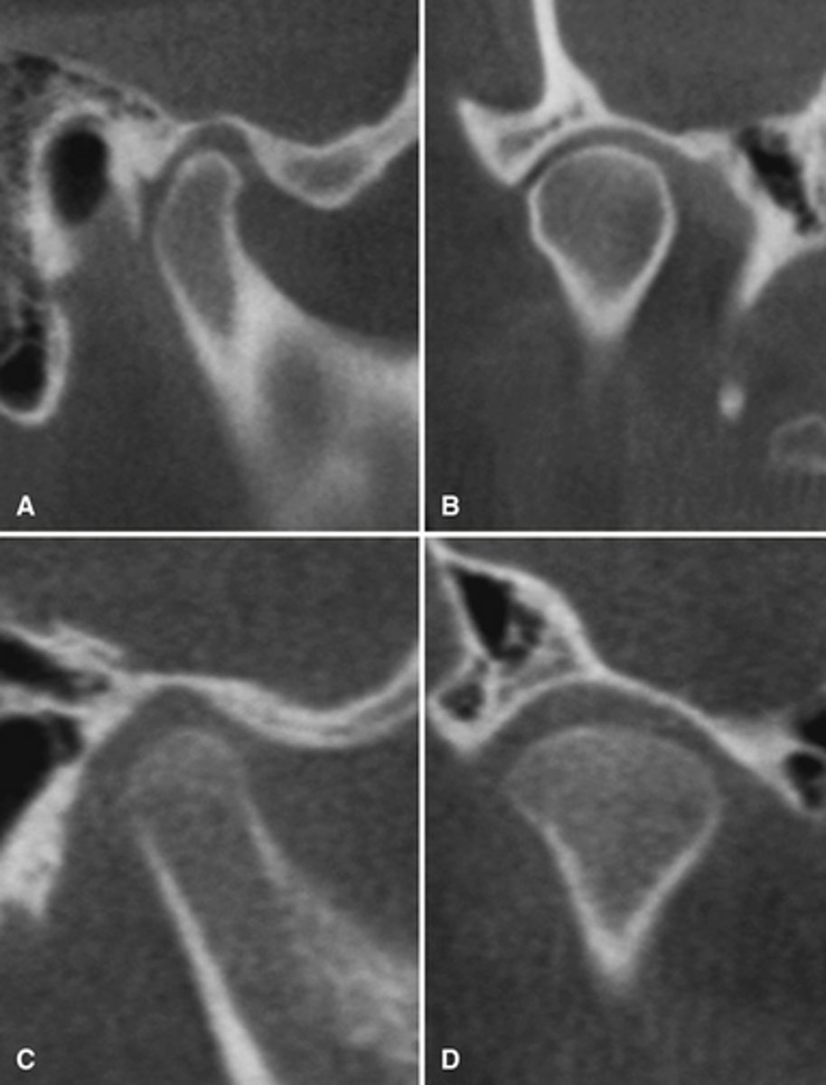 <p>The top images are being compared to the bottom images, which patient is younger and what are all the ways to know this.</p>