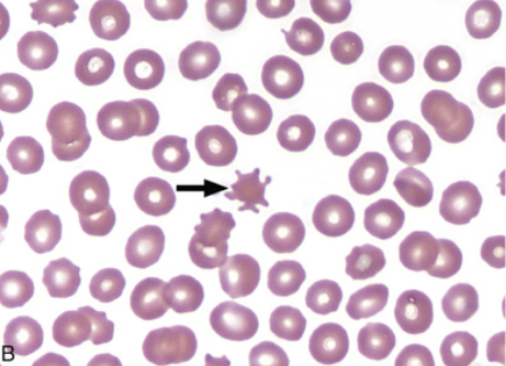 <p>what type of RBC abnormality is this</p>