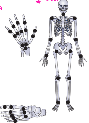 <p><strong>Rheumatoid Arthritis: Joints Affected</strong></p><p>-Fingers</p><ul><li><p>___ and ___ joints most common</p></li><li><p>MCP subluxation, ______ deviation, ____ ____ and Boutonniere deformities, and decreased grip </p></li></ul><p>-Feet</p><ul><li><p>MTP joints most common</p></li><li><p>_____ drift of toes, plantar ___________ of metatarsal heads </p></li></ul><p>-Wrists</p><ul><li><p>Loss of __________, volar subluxation, and _____ drift </p></li></ul><p>-Elbows</p><p>-_______</p><p>-Knees </p><p>-C_ and C_ can also be affected, leading to life threatening subluxation </p><p></p>